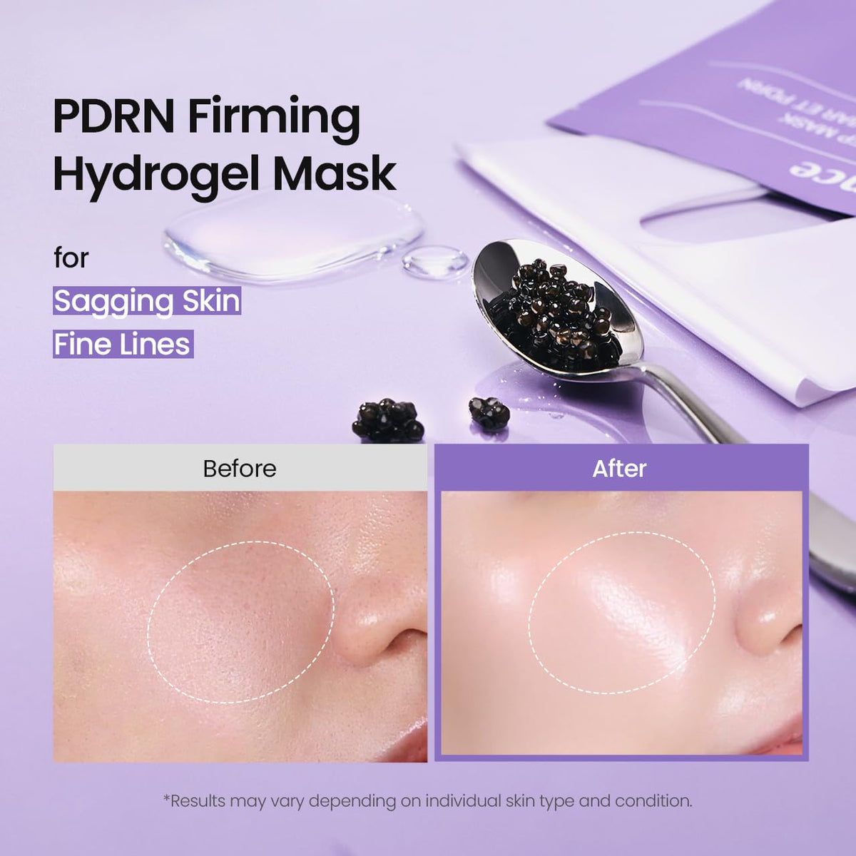 Rejuvenating Caviar PDRN Real Deep Mask, Overnight Hydrogel Face Mask, Skin Firming, Radiance, Enhancing Skin Recovery, Korean Skin Care, Self Care Gifts for Women | 1.19Oz(34G) X 4Ea