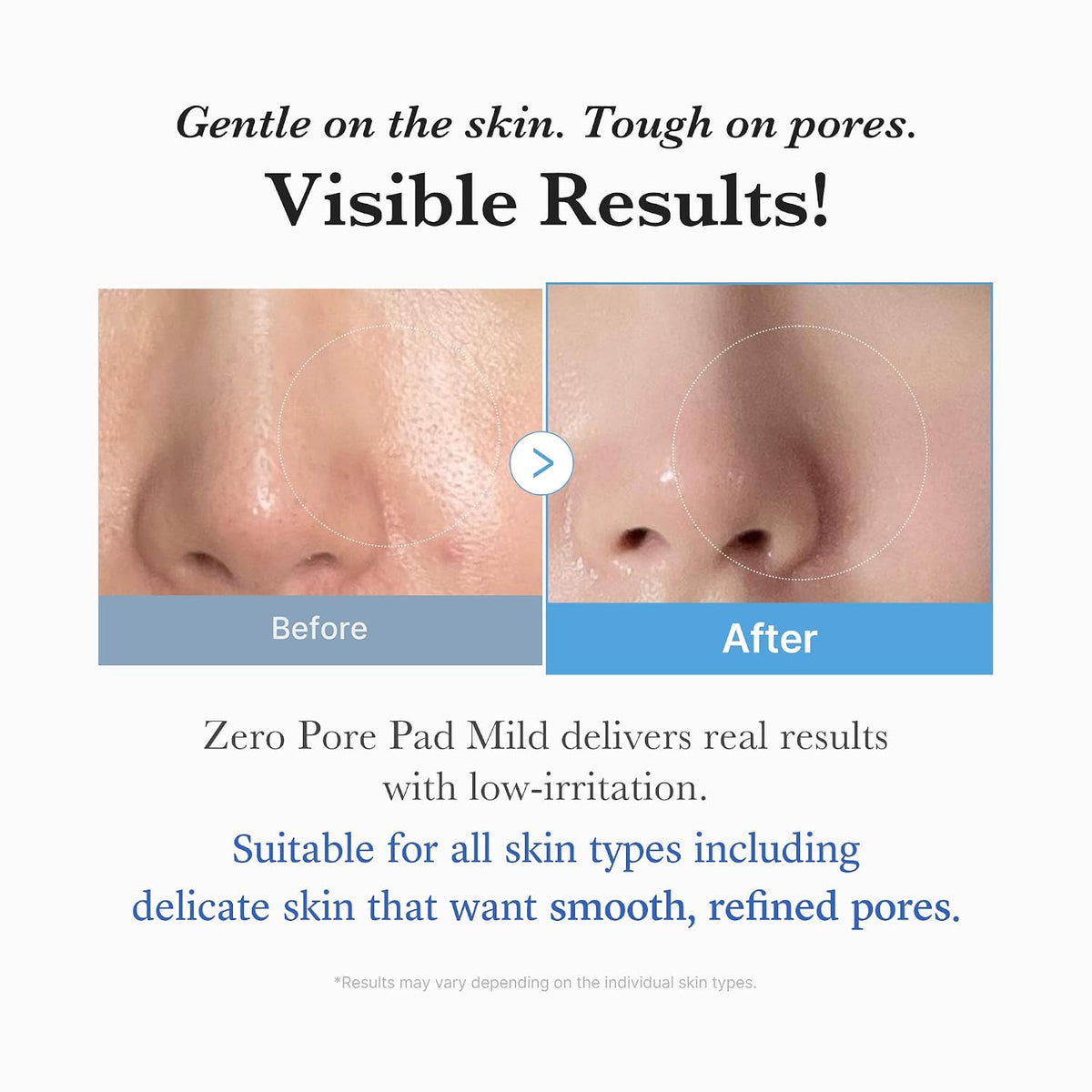 Toner Pads Zero Pore Pad Mild 2.0 for Gentle Exfoliating